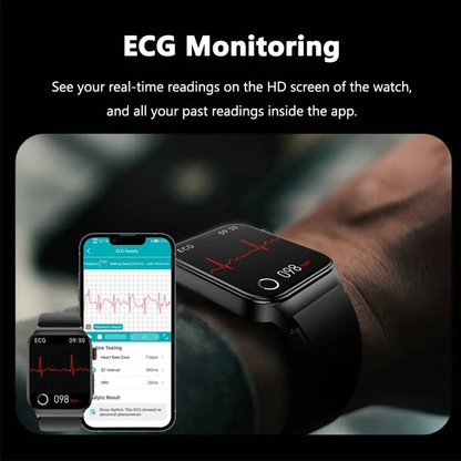 Avanceret smartwatch til sundhedsovervågning med EKG