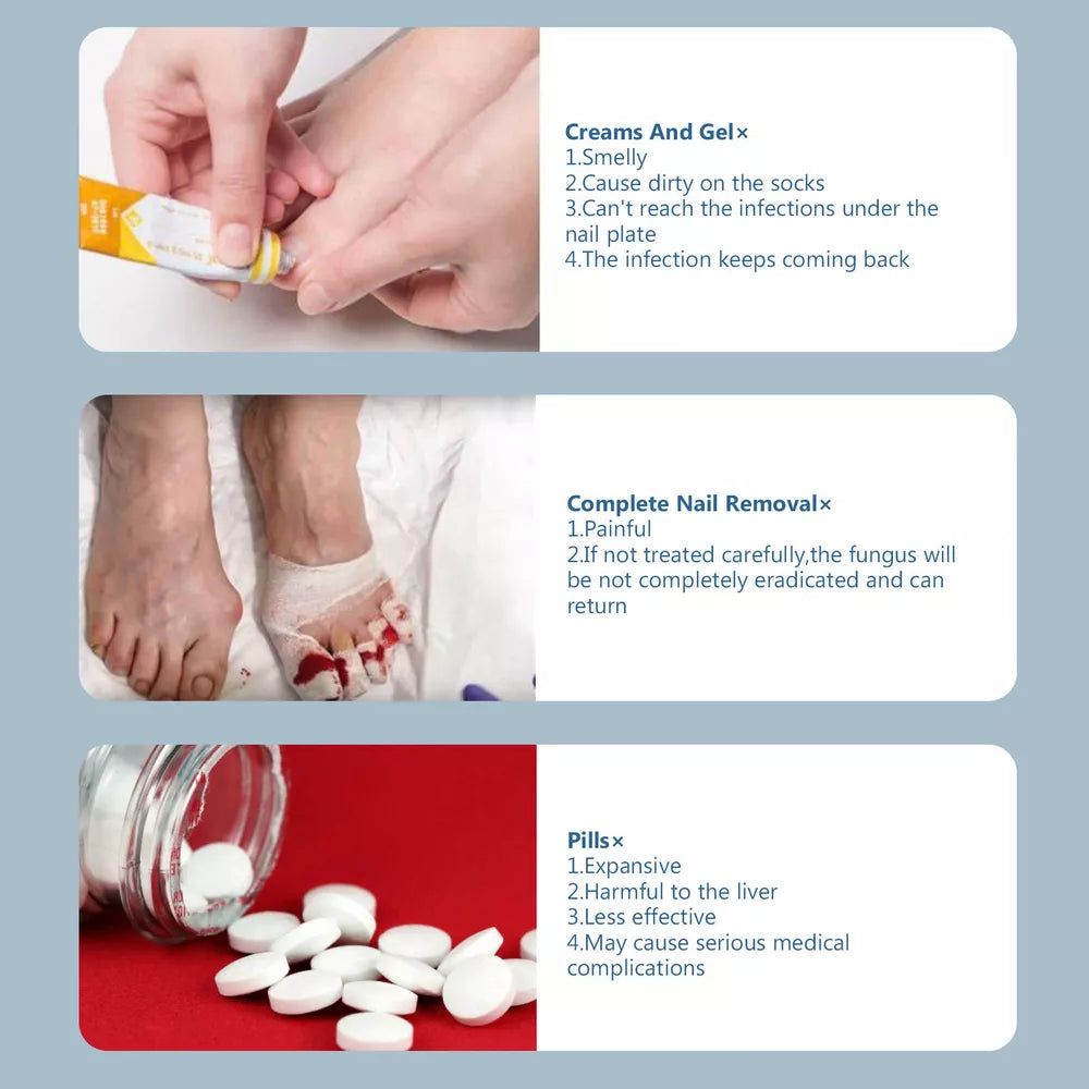 NailCare Laserbehandling mod Neglesvamp – Dobbeltbølget Terapi