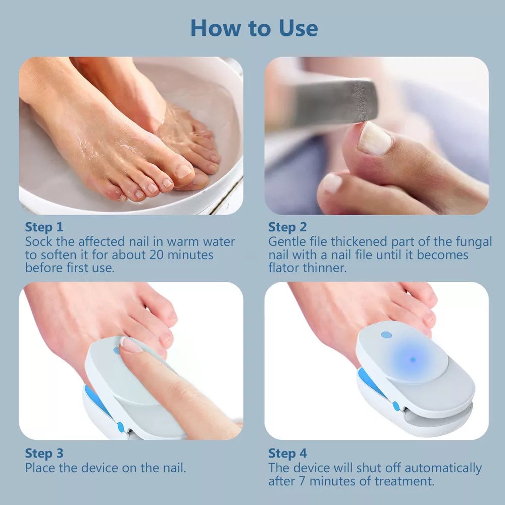 NailCare Laserbehandling mod Neglesvamp – Dobbeltbølget Terapi